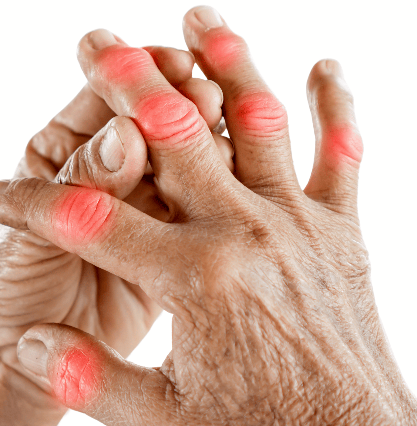 TUVIVEX INTENSIVE PAIN CREAM SUPPORTING ENHANCED CONFIDENCE AND COMFORT